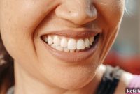 Masseter Reduction Treatments: Evolution, Methods, and Results